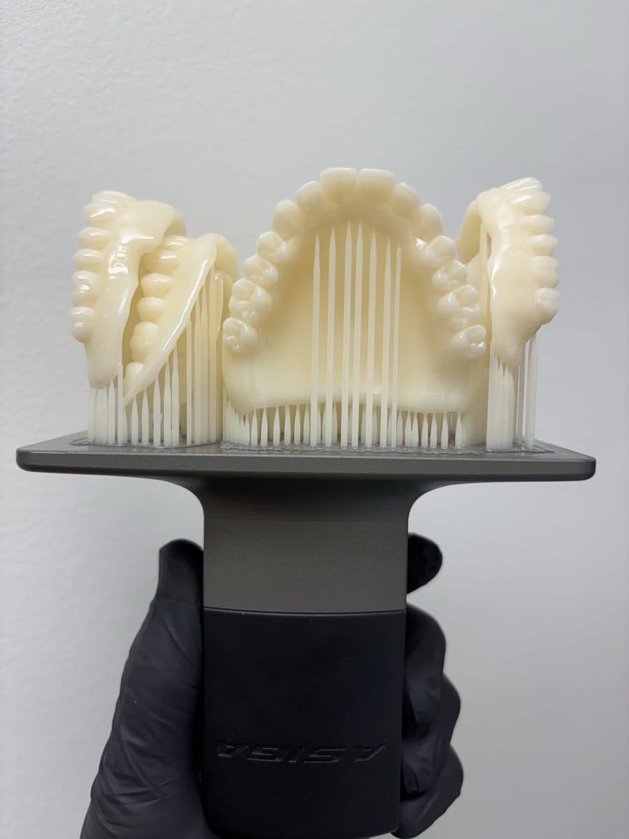 3D printed dentures